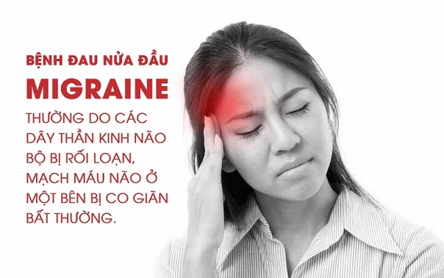 Có nhiều nguyên nhân gây đau nửa đầu, nhưng chưa có nghiên cứu kết luận nguyên nhân chính gây bệnh
